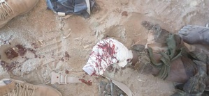 image d'un soldat tchadien blessé à Miski