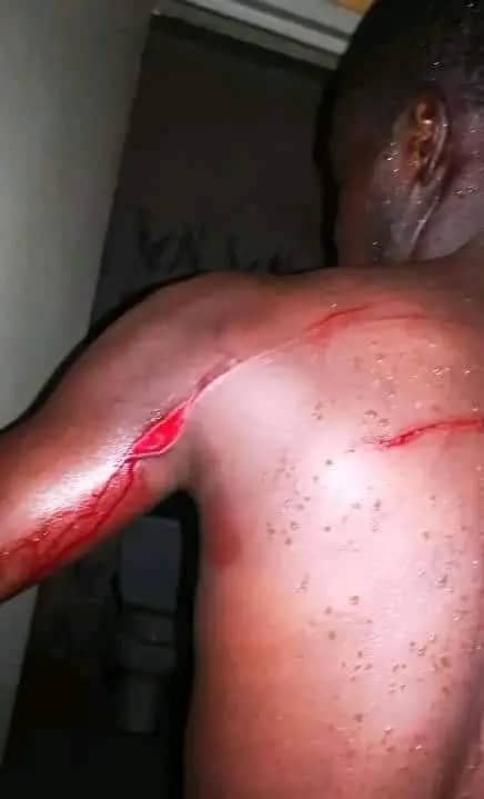 Insécurité : un opérateur de prise de vues attaqué à la machette.