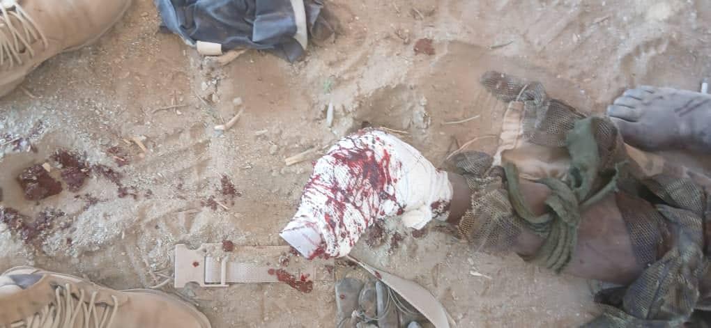image d'un soldat tchadien blessé à Miski