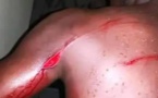 Insécurité : un opérateur de prise de vues attaqué à la machette.