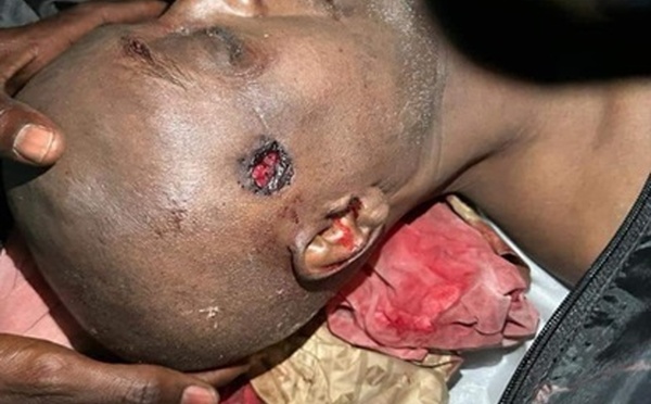 2 400 morts dans des conflits communautaires et politiques, depuis l’arrivée de la junte militaire au pouvoir au Tchad