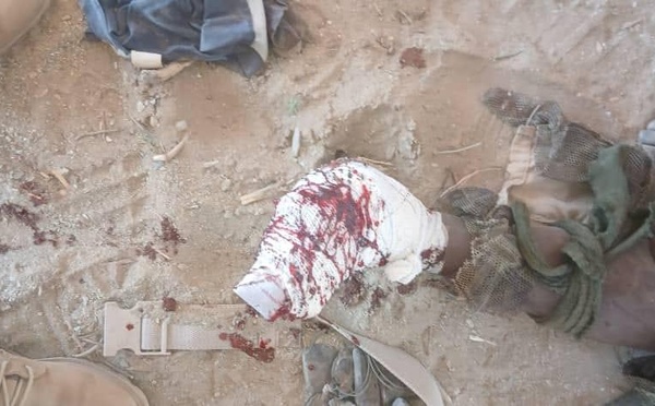 Du sang versé à Miski : le Tchad face à l’urgence de la Justice
